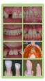 /album/prosthodontics/prosthodontois-1-jpg/